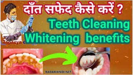 How To Whiten Teeth