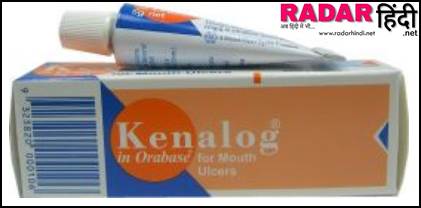 टैबलेट मुंह के छाले की अंग्रेजी दवा का नाम Kenalog Ulcer Gel for Mouth