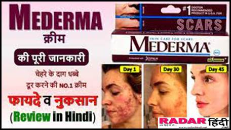 Mederma Cream Uses In Hindi