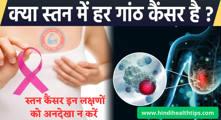 Breast Cancer Kaise Hota Hai Aur Uske Symptoms In Hindi